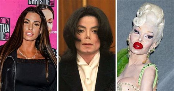 10 Extreme Cases of Celebrity Wannabe Plastic Surgery