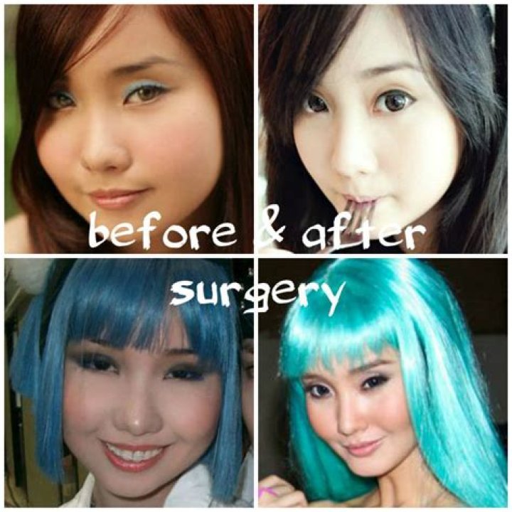 Did Cosplay Star Alodia Gosiengfiao Ever Do Plastic Surgery?