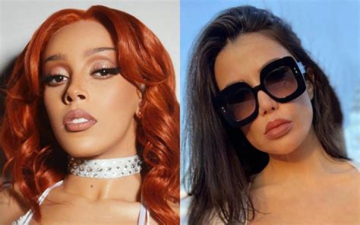 
Doja Cat Has Called Out Lorry Hill For Falsely Accusing Her Of Getting Plastic Surgery 