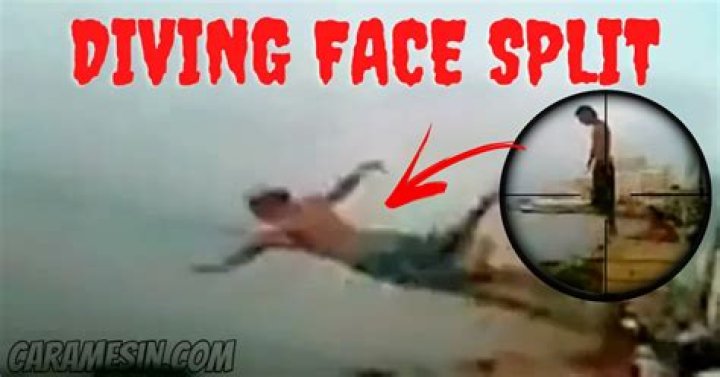 Face Split Diving Accident Video Gone Viral On Twitter And Reddit