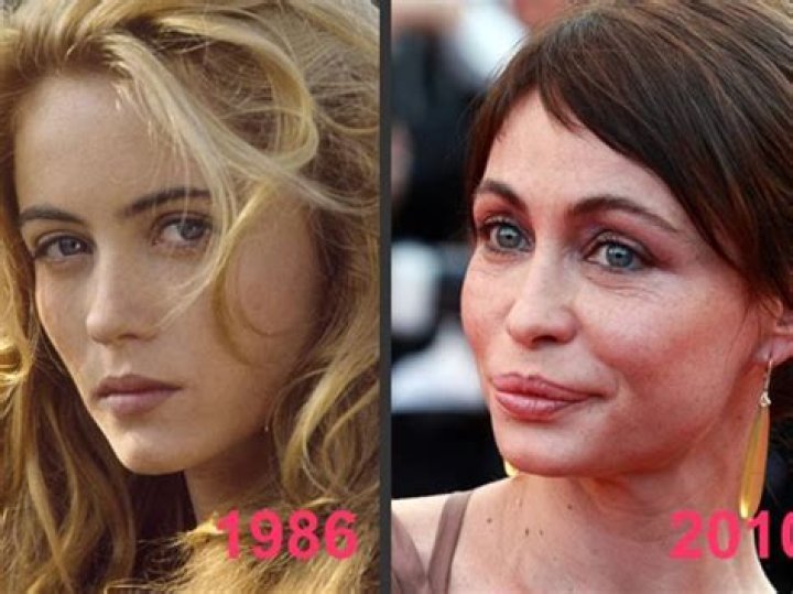 French actress Emmanuelle Beart warns against plastic surgery after botched job