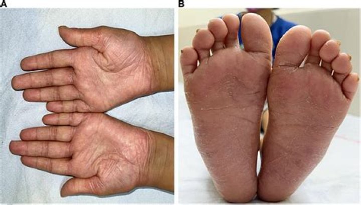 P.J. Soles Bio (Wiki) 