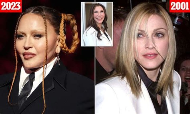 
Rachael Ray Plastic Surgery Before And After | Why The American Cook Face Looks So Different 