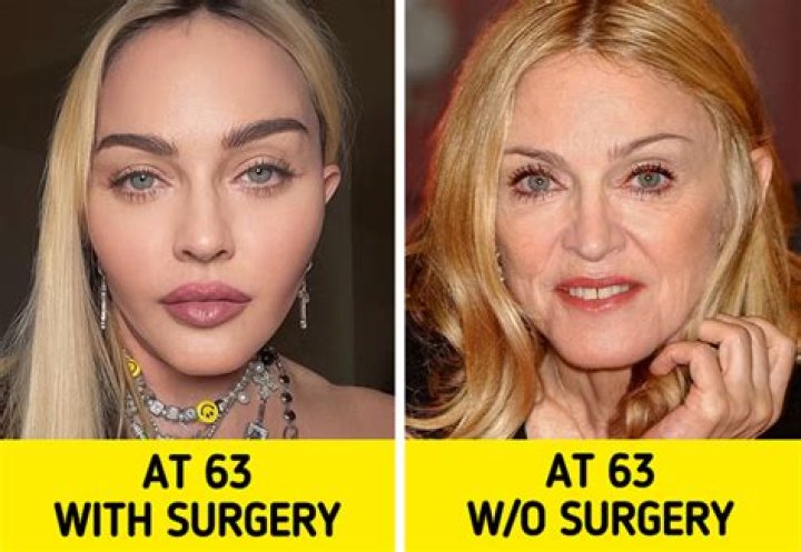 Sunshine Guimary Wikipedia Bio – Who Is She? Plastic Surgery And Age Revealed